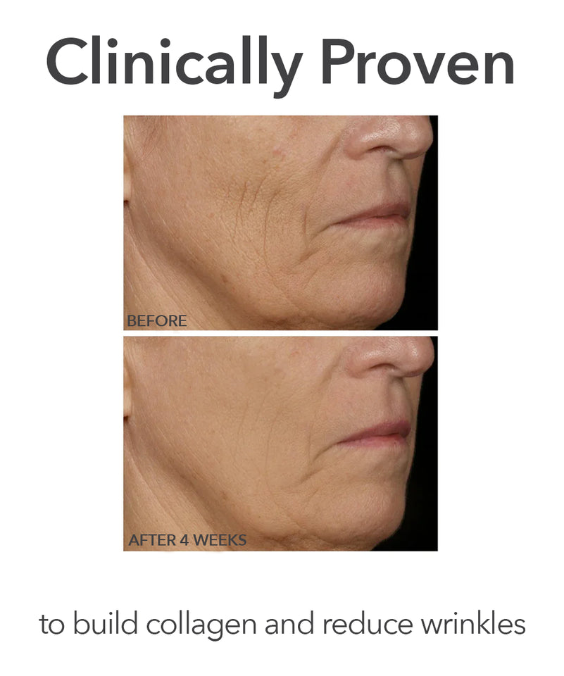 DR. DENNIS GROSS SKINCAR - Bring The Clinic Home Faceware Pro Led Device Bundle