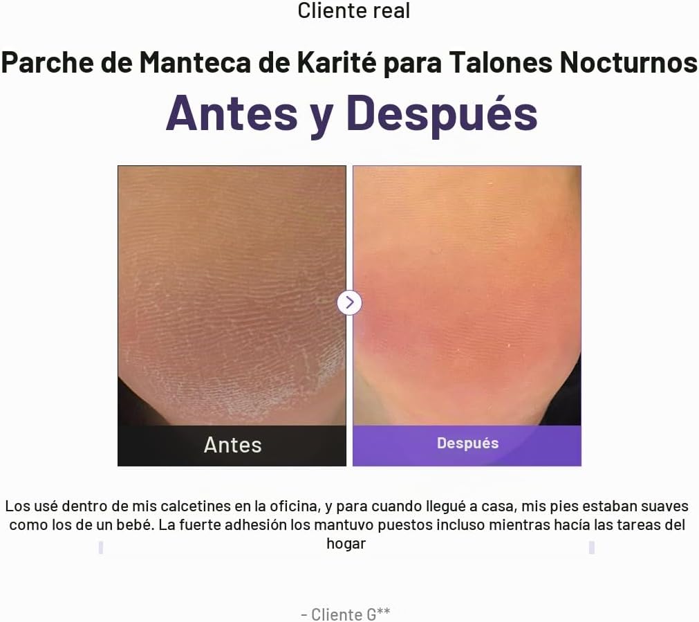 Baren - Parches nocturnos para pies con manteca de karité Shea Butter Sleeping Heel Patch