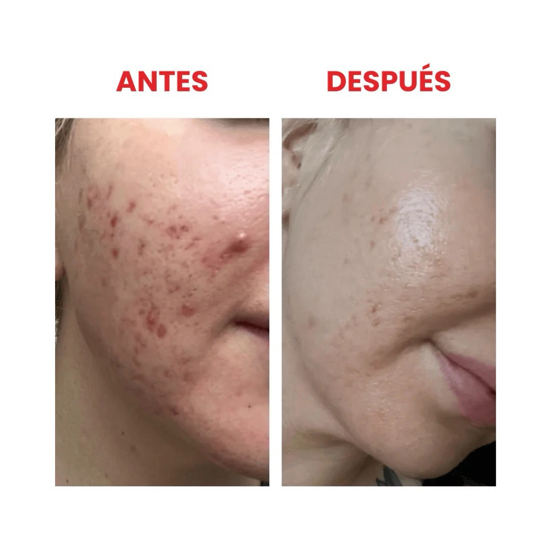 NINELESS - Molecule-Clear 5% Mandelic Acid Serum