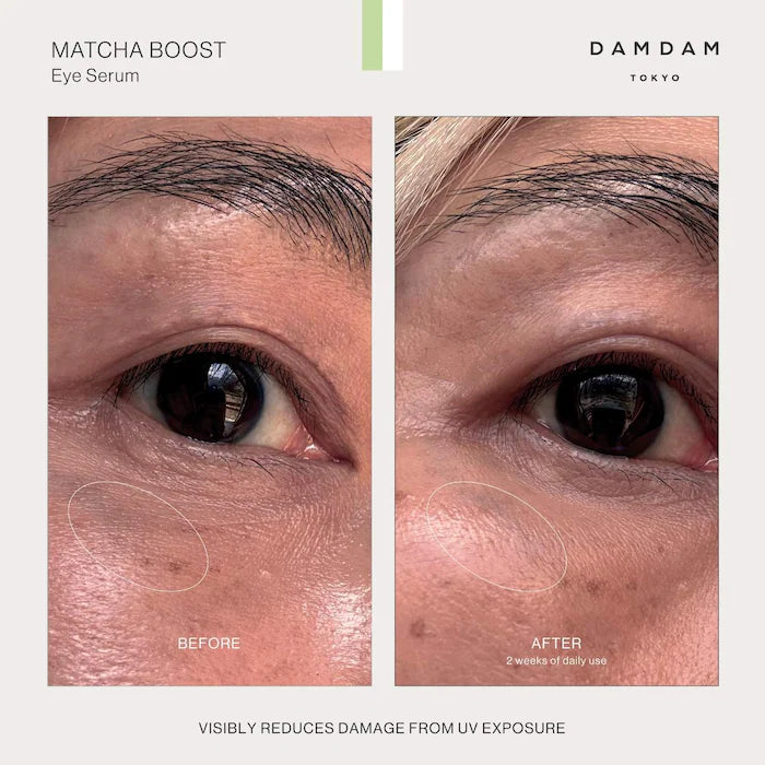 DAMDAM - Matcha Boost Hydrating & Restorative Eye Serum **BAJO-PEDIDO**