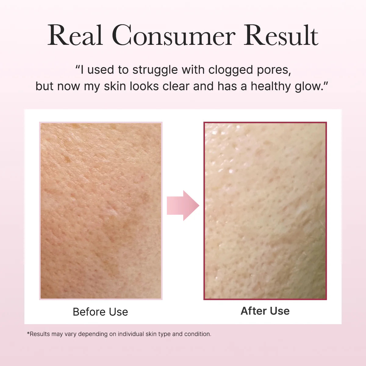 Arencia - Limpiador Facial Fresh Rosehip Rice Mochi Cleanser