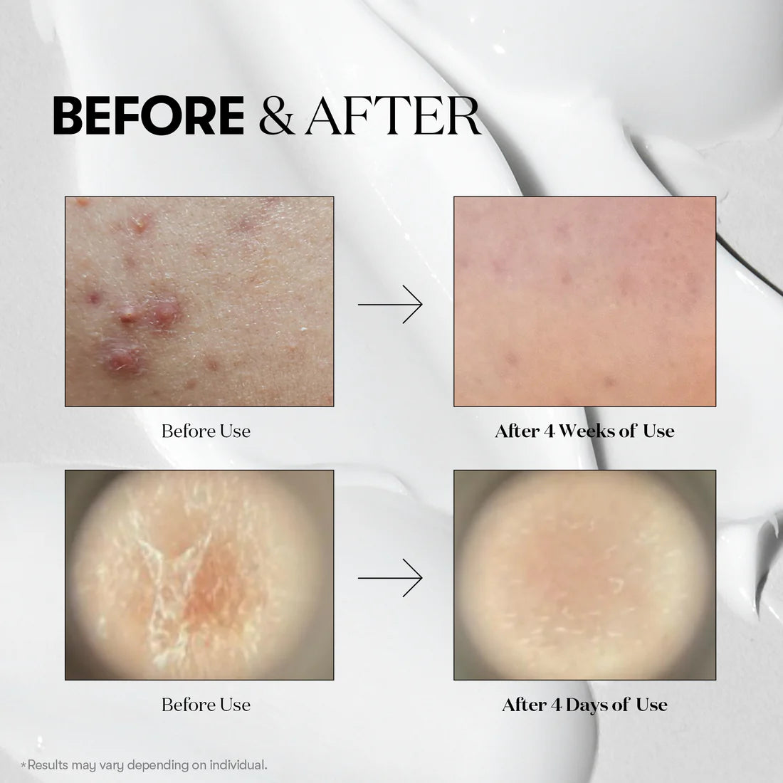 VT COSMETICS - VT Reedle Shot 50