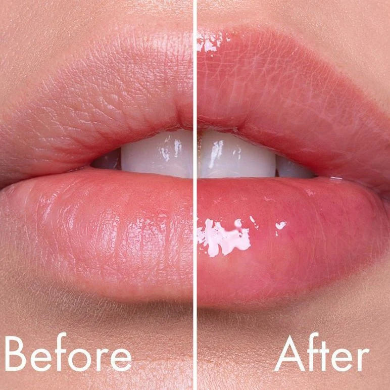 VT - Reedle Shot Lip Plumper Usagi Pink