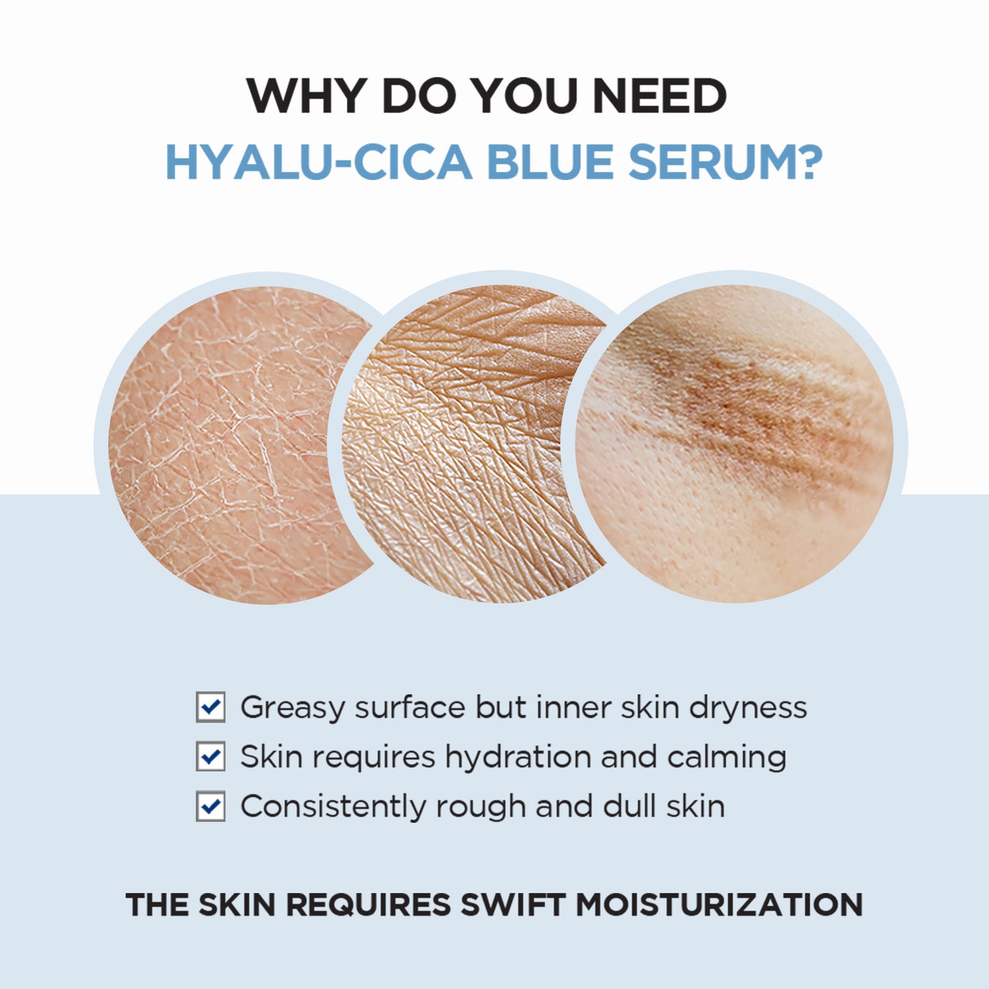 SKIN1004 - Hyalu-Cica Blue Serum
