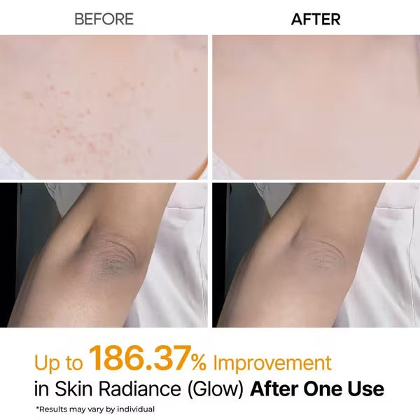 Dr.Melaxin - Peel Shot Exfoliating Kojic Acid Turmeric Spray