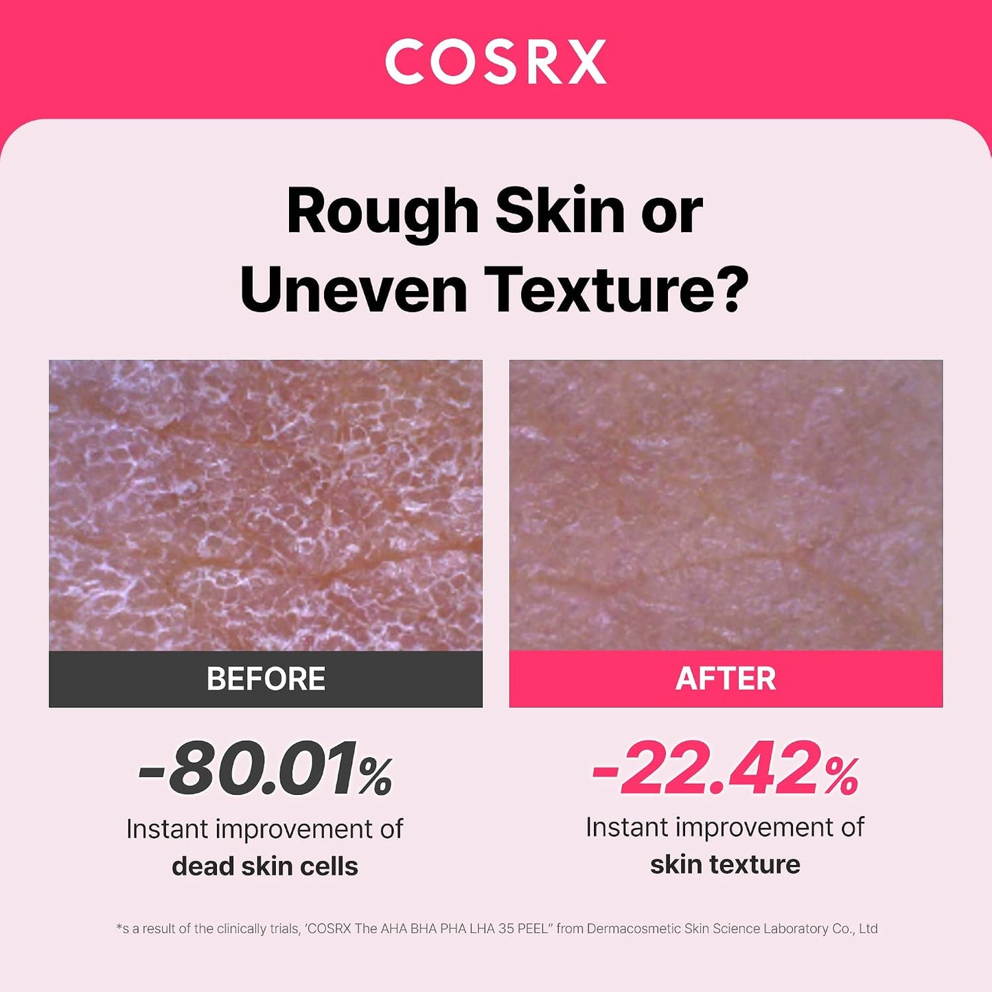 COSRX - AHA BHA PHA LHA 35% Gel Exfoliante