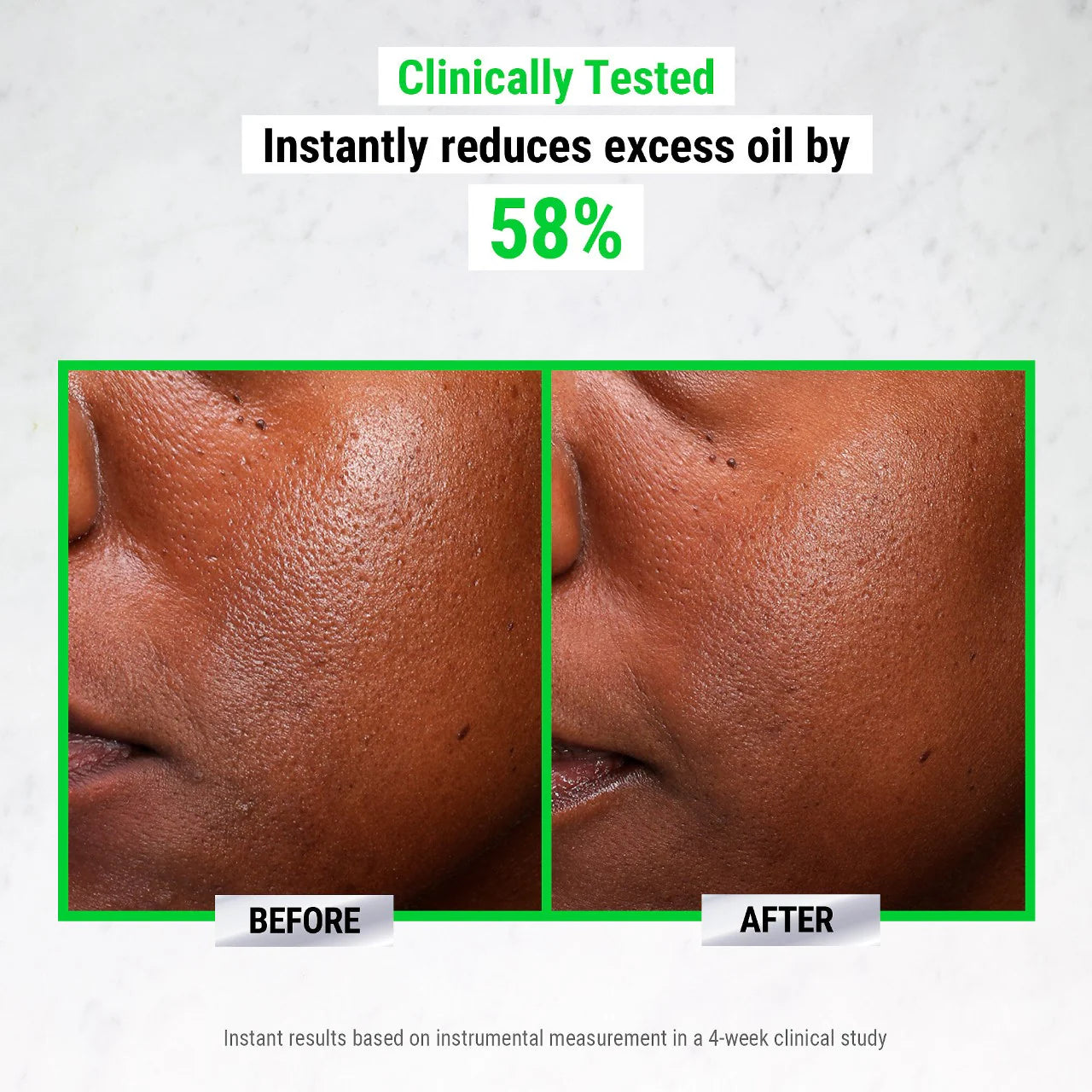 Kiehl's Since 1851 - Ultra Pure High-Potency 5.0% Niacinamide Serum **BAJO-PEDIDO**