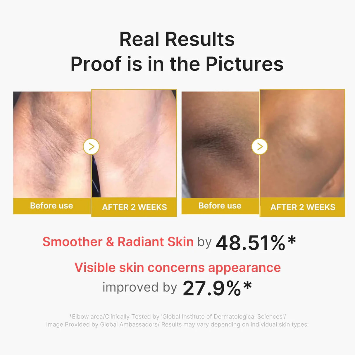 Medicube - Kojic Acid Turmeric Body Peel Shot