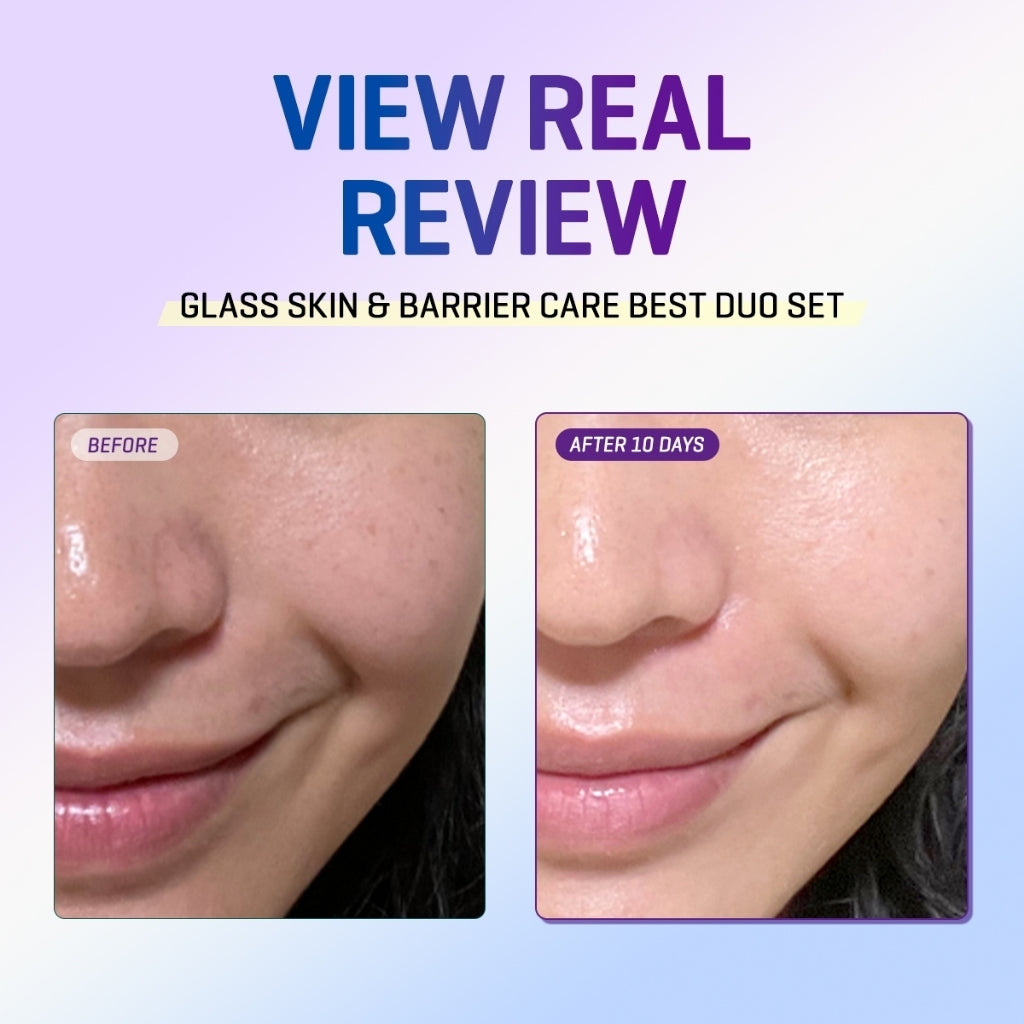 Some By Mi - Retinol Intense Reactivating Serum