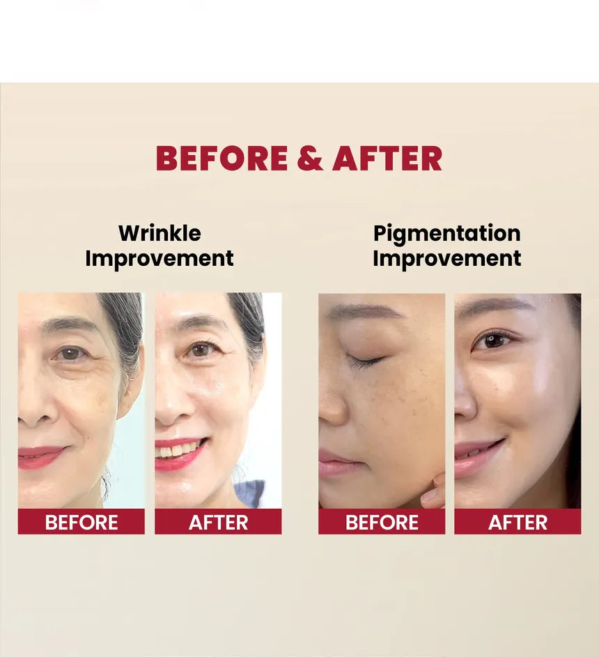 KSECRET - Sérum Facial SEOUL 1988 Serum: Retinal Liposome 2% + Black Ginseng