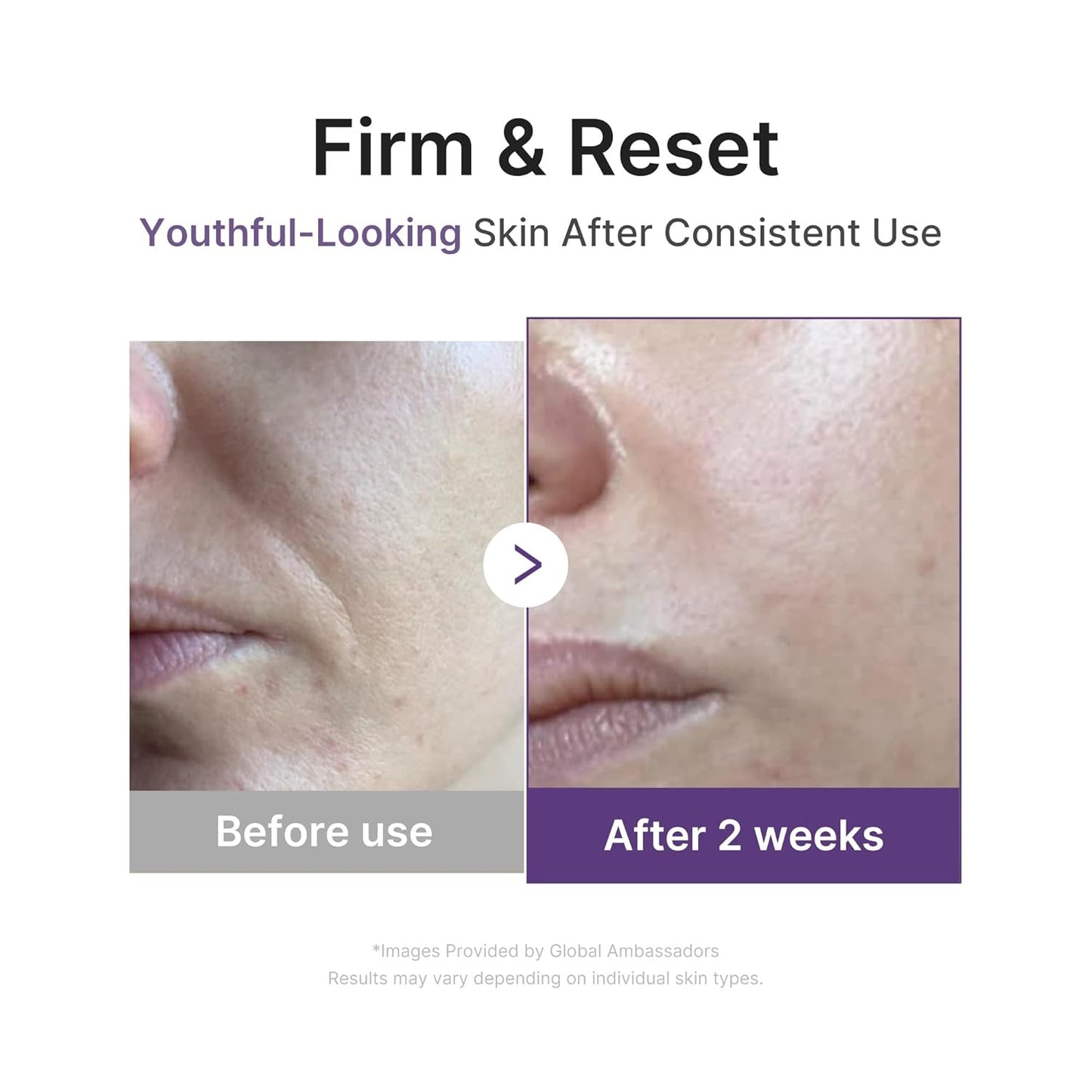 Medicube - Retinol NMN Boosting Serum