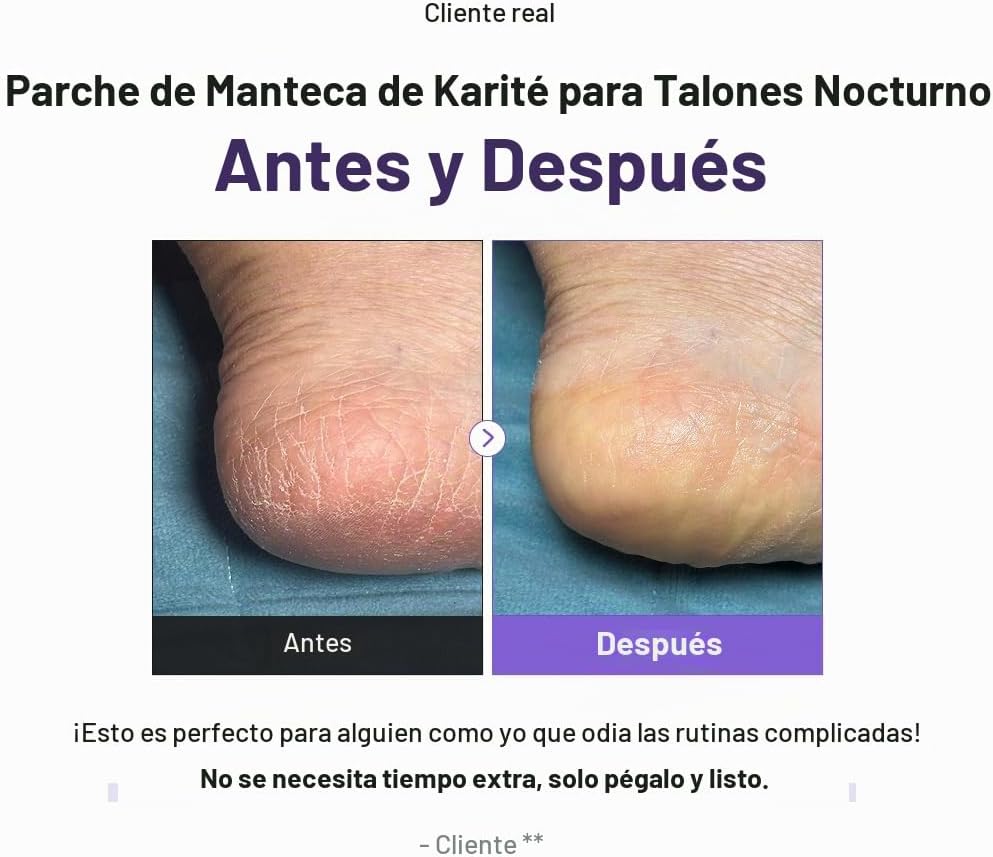 Baren - Parches nocturnos para pies con manteca de karité Shea Butter Sleeping Heel Patch