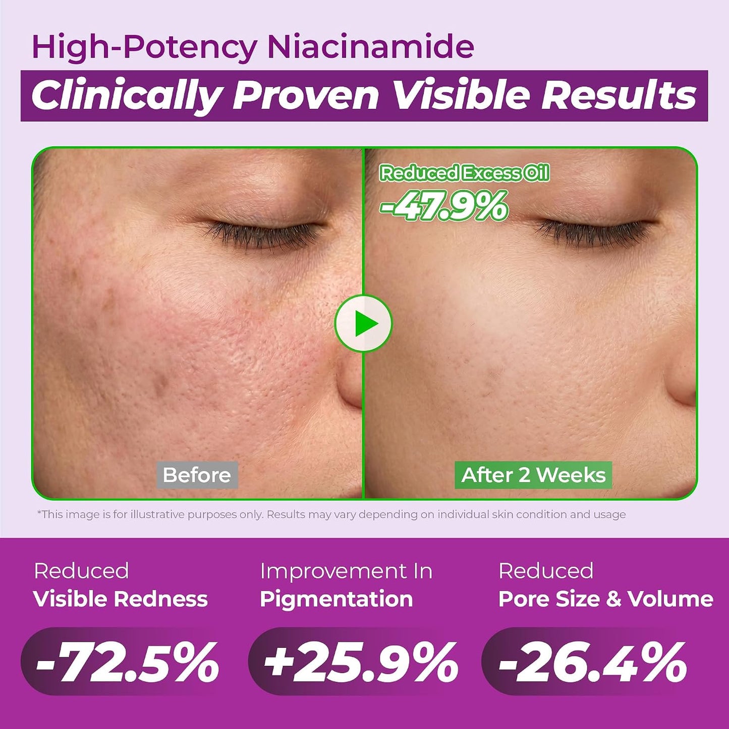JUMISO - Niacinamide 10 Serum