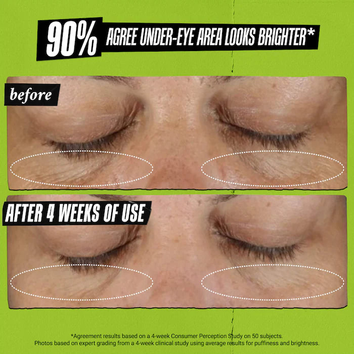 Kiehl's - Mini Avocado Eye Cream for Brightening & Depuffing