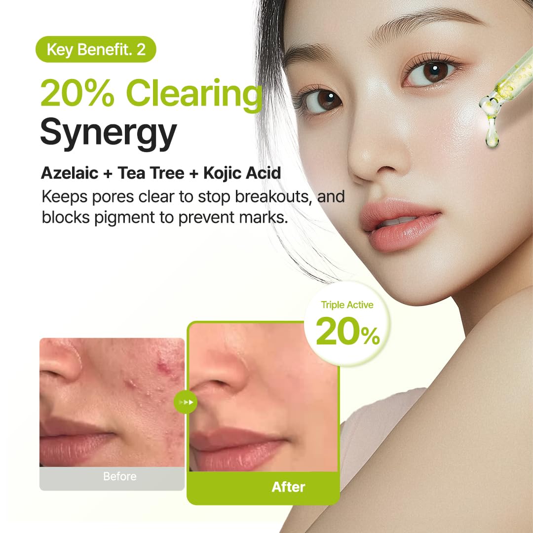 Purito - Azelaic Acid 10 Kojic Tea Tree Serum