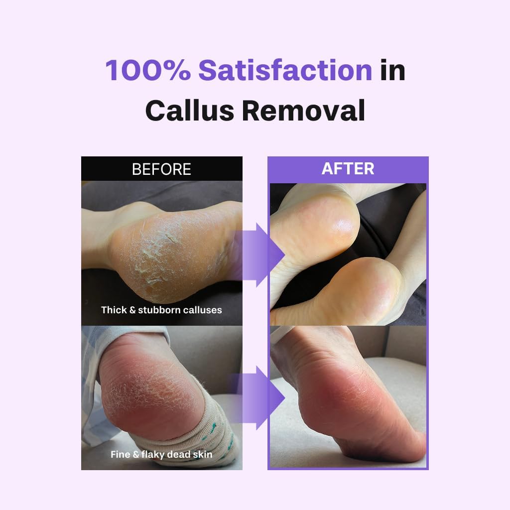 Baren - Foot Exfoliant Softener at Home Kit