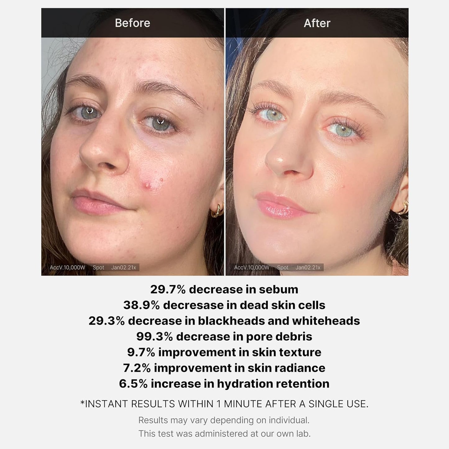 Medicube - Red Acne Succinic Acid Peel