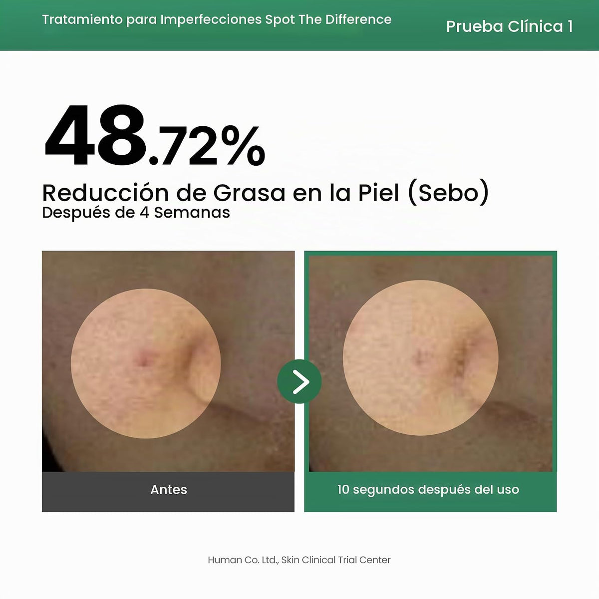 AXIS-Y - Spot The Difference Blemish Treatment