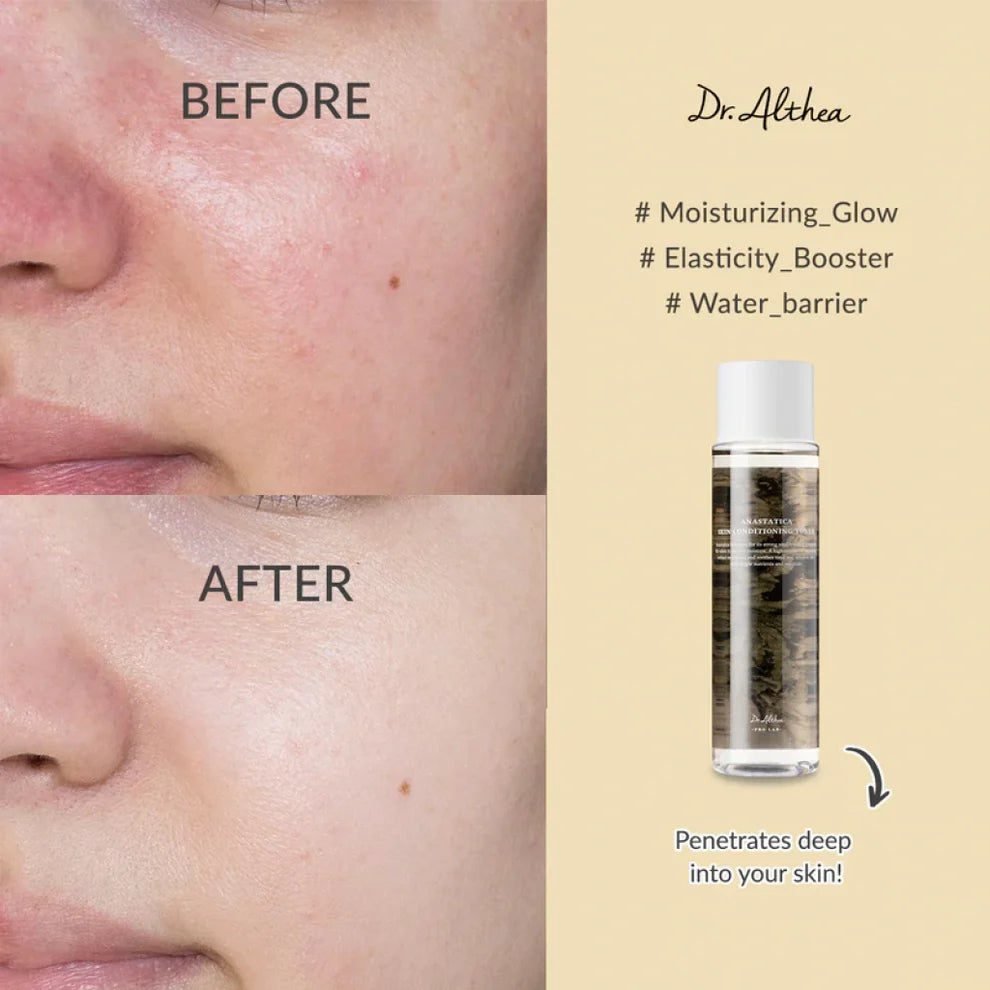 Dr. Althea - Anastatica Skin Conditioning Toner