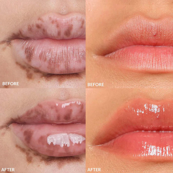 REFY - Mini Lip Gloss Set