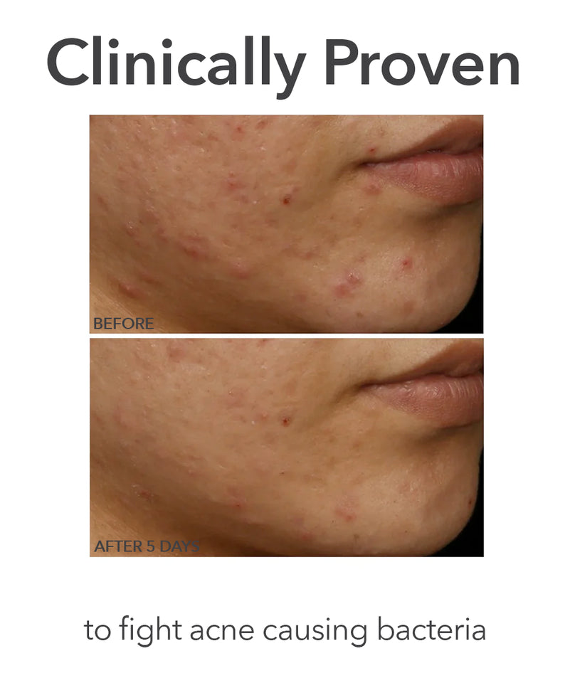 DR. DENNIS GROSS SKINCAR - Bring The Clinic Home Faceware Pro Led Device Bundle