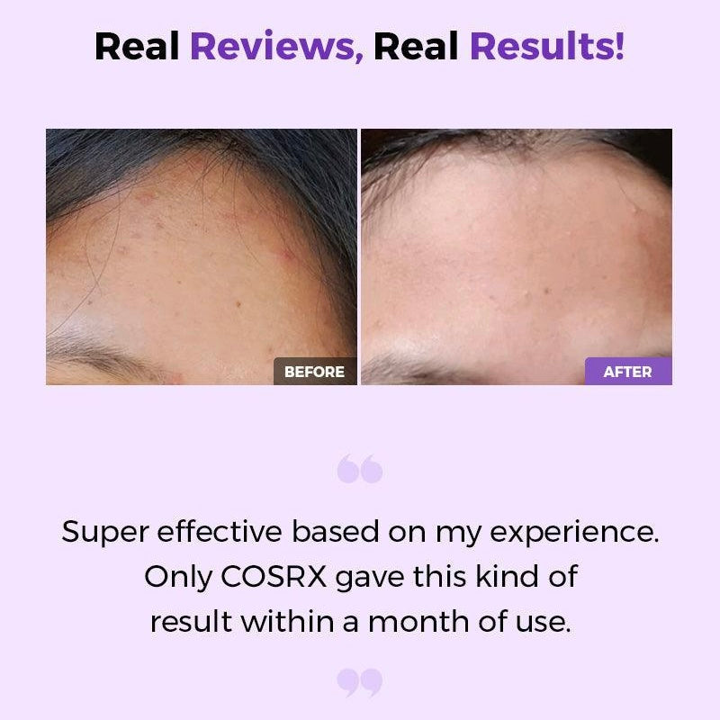 COSRX - AHA/BHA Clarifying Treatment Toner