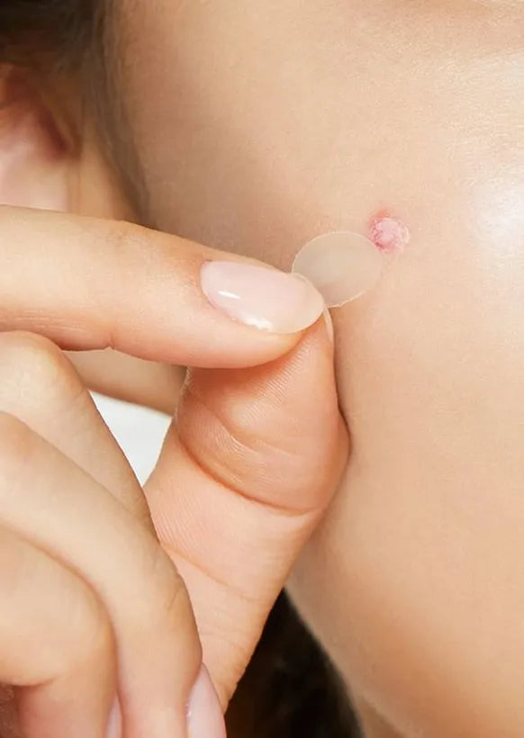 COSRX - Parche Clear Fit Master Patch