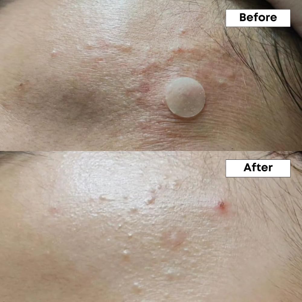 NINELESS - A-Control Azelaic Acid Toner
