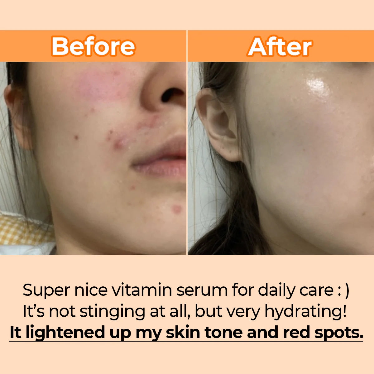 Numbuzin - Serum Goodbye Blemish