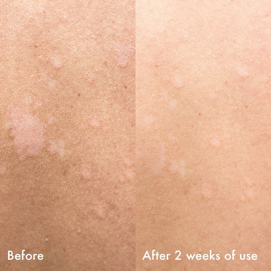 Brilliantly Bright Body Cleansing Wash with Vitamin C & Niacinamide**BAJO-PEDIDO**