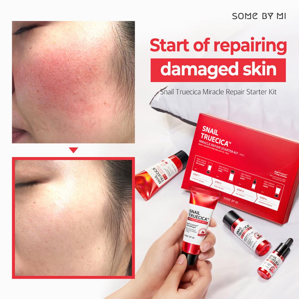 Some By Mi - Snail Truecica Miracle Repair Starter Kit
