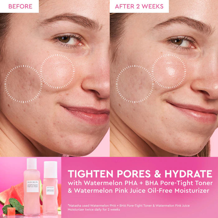 Glow Recipe - Mini Watermelon Pink Juice Moisturizer