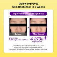 NINELESS B-Boost 1% Kojic Acid Radiant Glow Serum