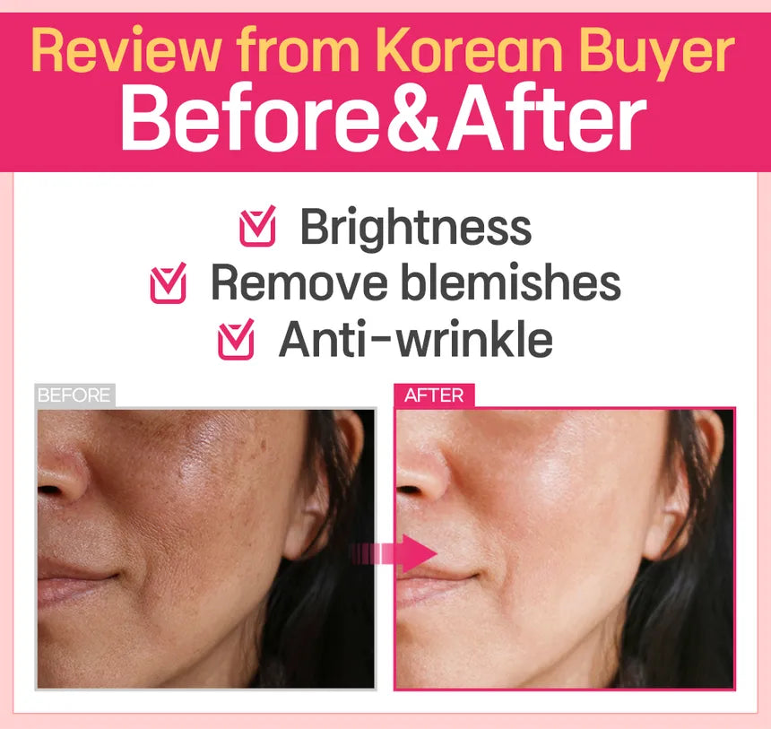 Boto - Small Molecular Collagen C